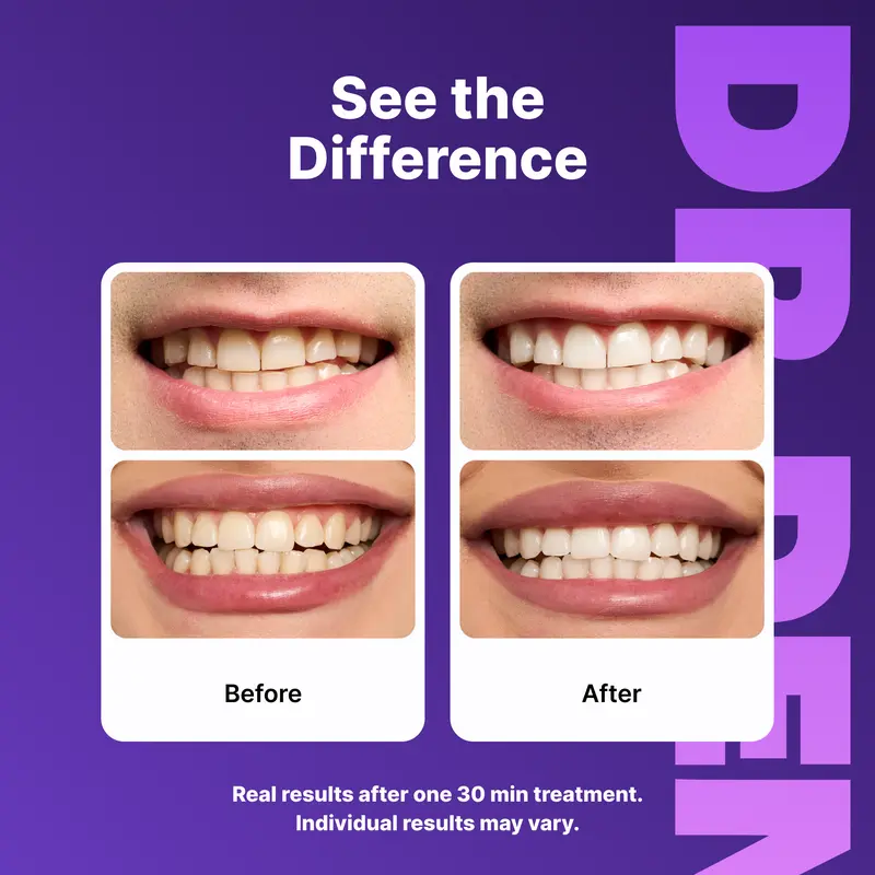 PurpleStrips®